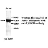 PRKCH Antibody from Signalway Antibody (39256) - Antibodies.com