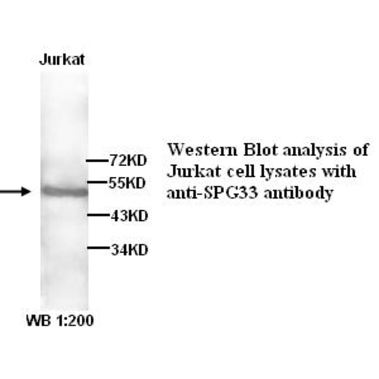 SPG33 Antibody from Signalway Antibody (39264) - Antibodies.com