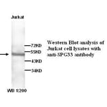 SPG33 Antibody from Signalway Antibody (39264) - Antibodies.com