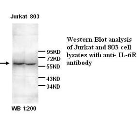 IL-6R Antibody from Signalway Antibody (39266) - Antibodies.com