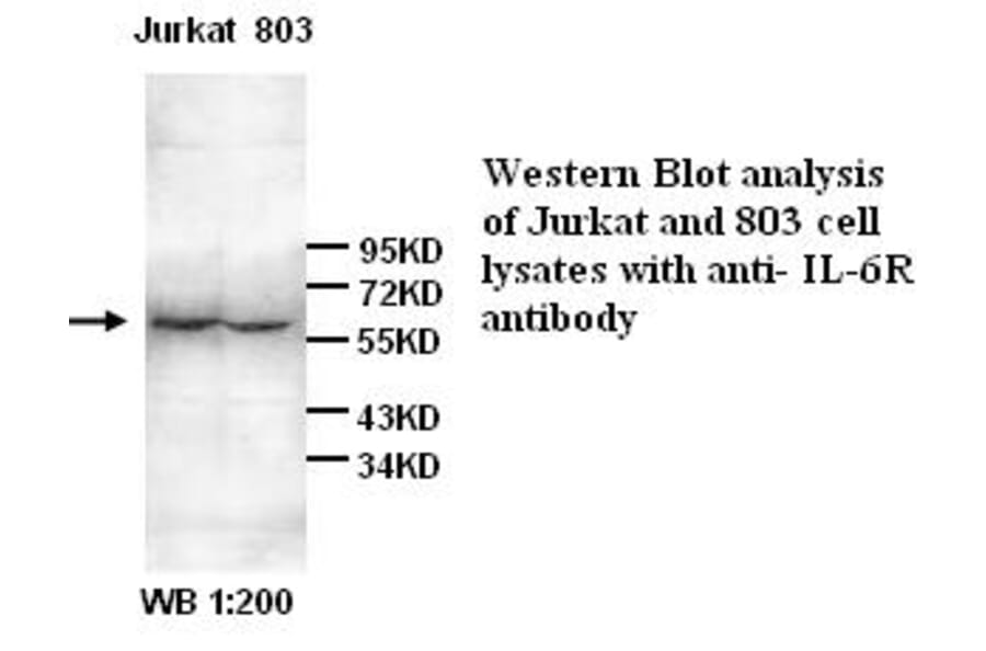 IL-6R Antibody from Signalway Antibody (39266) - Antibodies.com