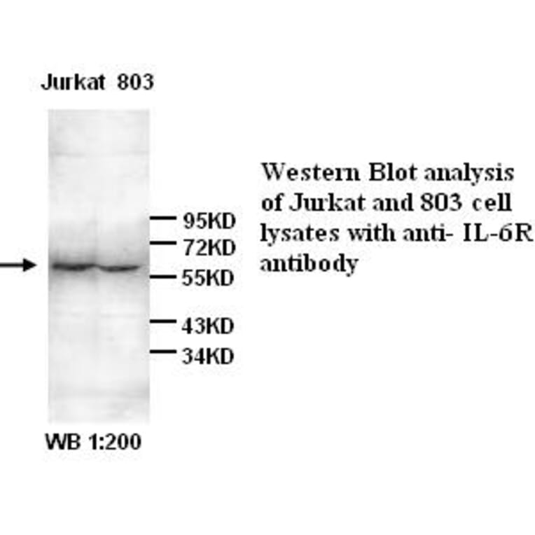 IL-6R Antibody from Signalway Antibody (39266) - Antibodies.com