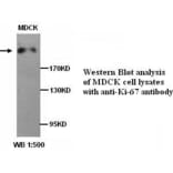 Ki-67 Antibody from Signalway Antibody (39270) - Antibodies.com