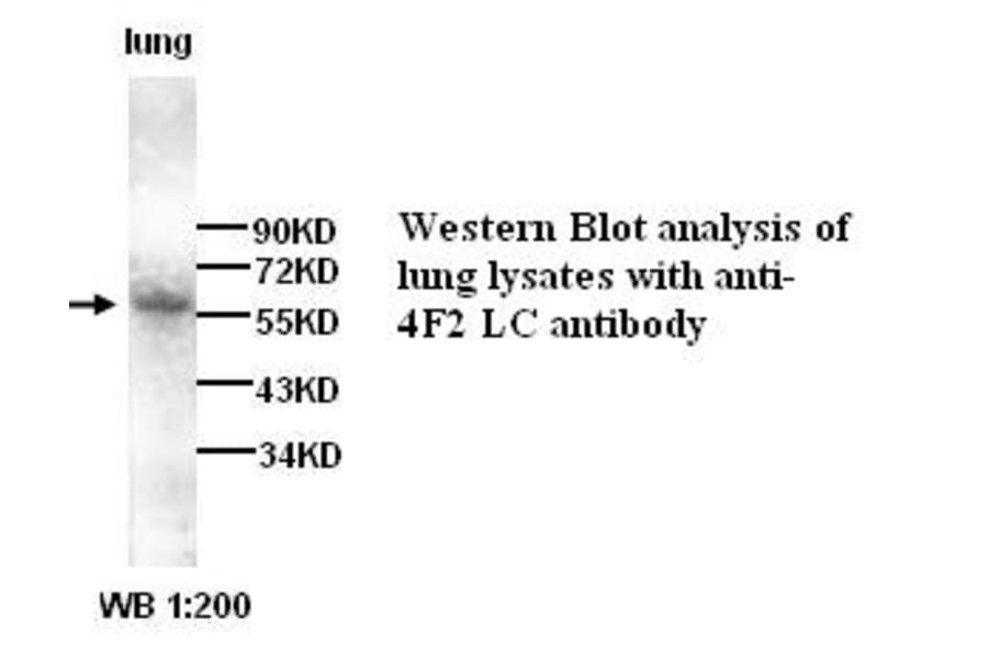 4F2LC Antibody from Signalway Antibody (39274) - Antibodies.com