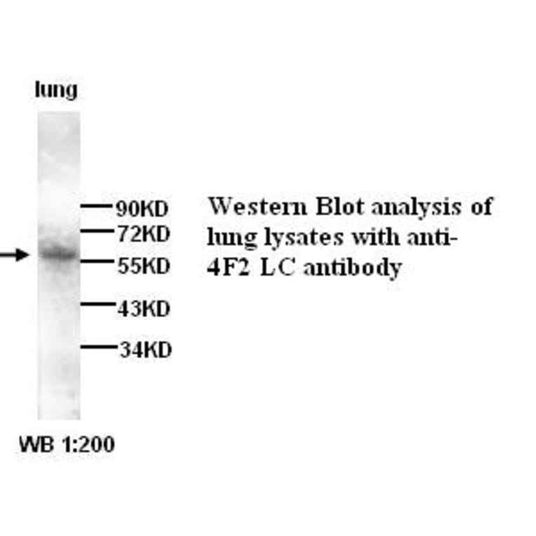 4F2LC Antibody from Signalway Antibody (39274) - Antibodies.com