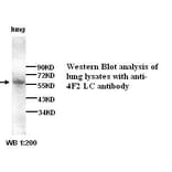 4F2LC Antibody from Signalway Antibody (39274) - Antibodies.com