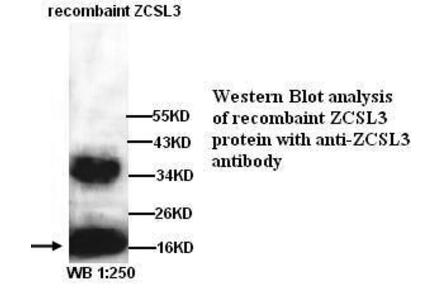 ZCSL3 Antibody from Signalway Antibody (39287) - Antibodies.com
