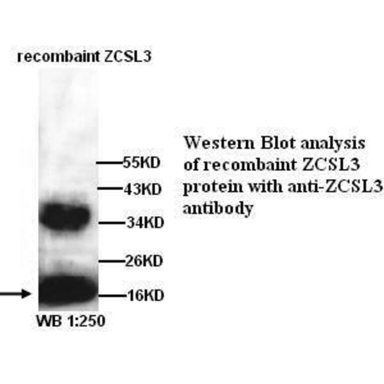 ZCSL3 Antibody from Signalway Antibody (39287) - Antibodies.com