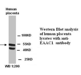 EAAC1 Antibody from Signalway Antibody (39289) - Antibodies.com