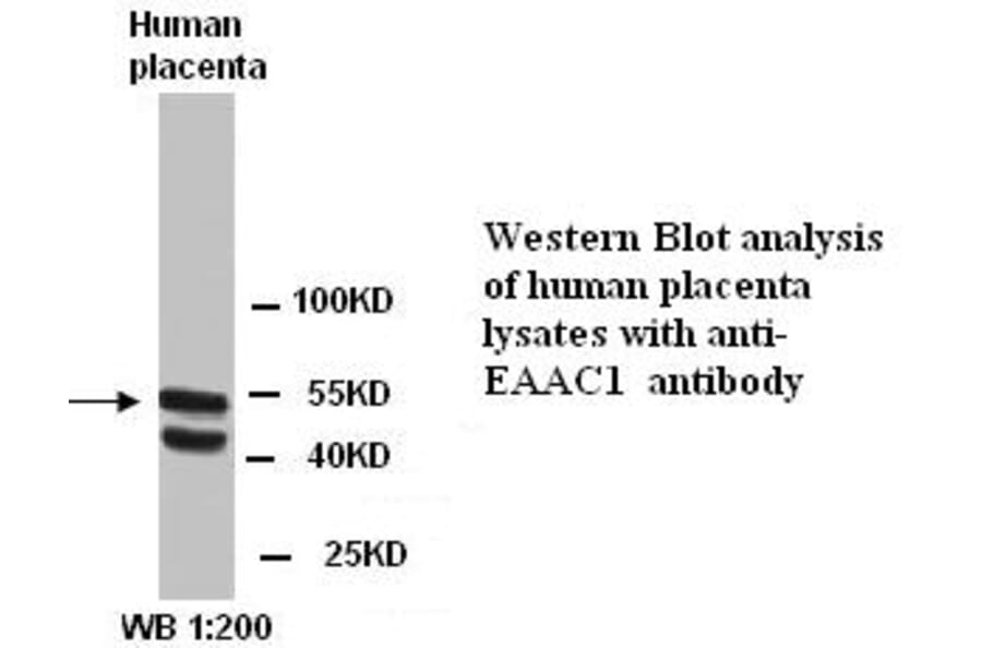 EAAC1 Antibody from Signalway Antibody (39289) - Antibodies.com