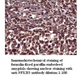 NFKB3 Antibody from Signalway Antibody (39294) - Antibodies.com