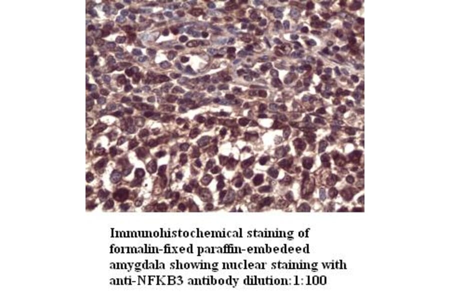 NFKB3 Antibody from Signalway Antibody (39294) - Antibodies.com