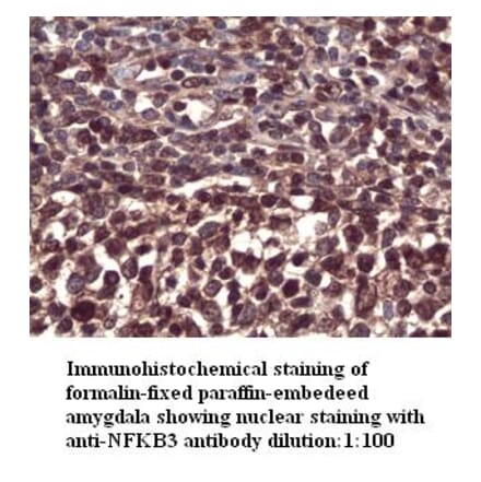 NFKB3 Antibody from Signalway Antibody (39294) - Antibodies.com