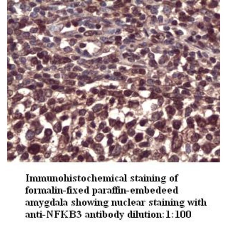 NFKB3 Antibody from Signalway Antibody (39294) - Antibodies.com
