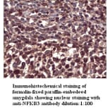 NFKB3 Antibody from Signalway Antibody (39294) - Antibodies.com