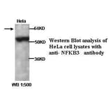 NFKB3 Antibody from Signalway Antibody (39294) - Antibodies.com