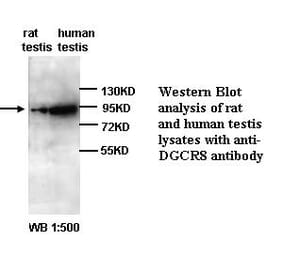 DGCR8 Antibody from Signalway Antibody (39295) - Antibodies.com