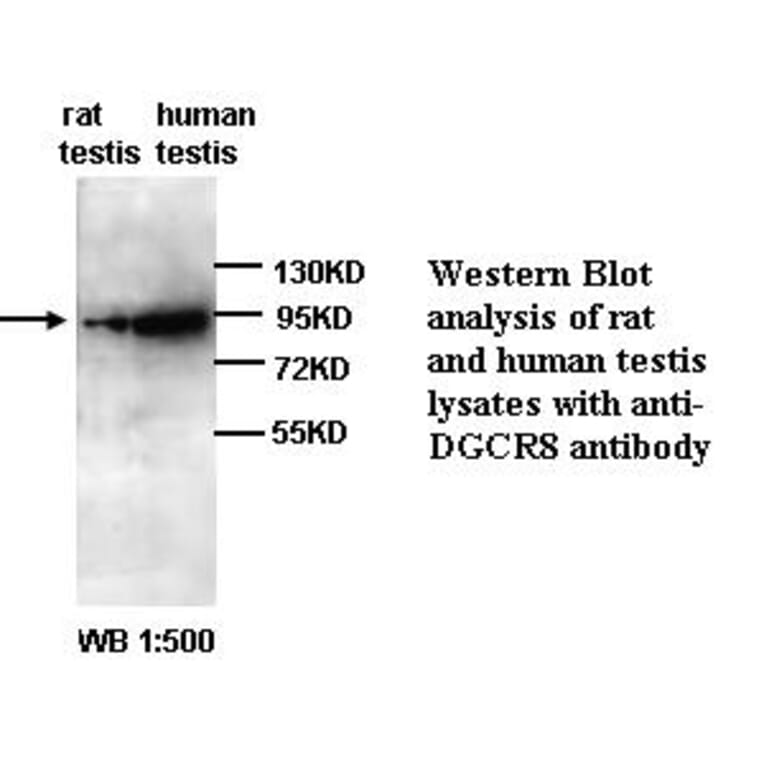 DGCR8 Antibody from Signalway Antibody (39295) - Antibodies.com