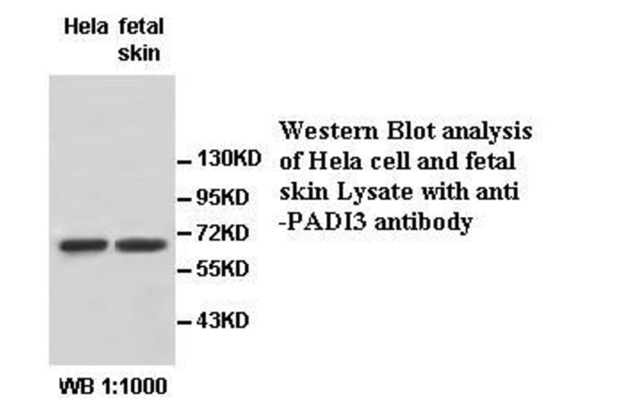 PADI3 Antibody from Signalway Antibody (39531) - Antibodies.com