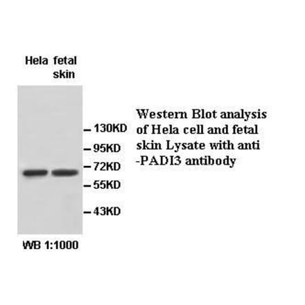 PADI3 Antibody from Signalway Antibody (39531) - Antibodies.com