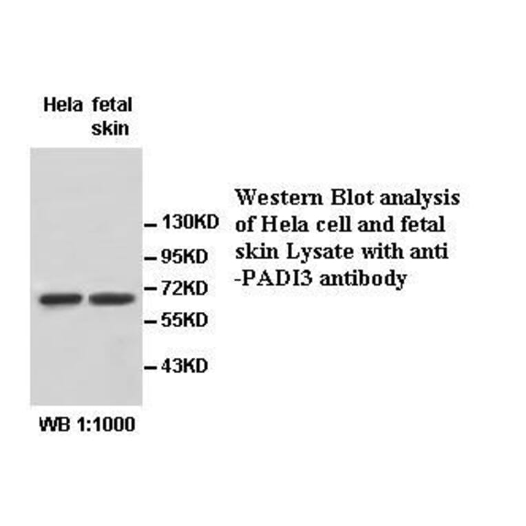 PADI3 Antibody from Signalway Antibody (39531) - Antibodies.com