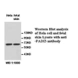 PADI3 Antibody from Signalway Antibody (39531) - Antibodies.com