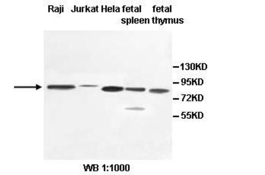 PCIF1 Antibody from Signalway Antibody (39532) - Antibodies.com
