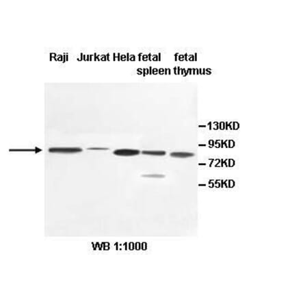 PCIF1 Antibody from Signalway Antibody (39532) - Antibodies.com