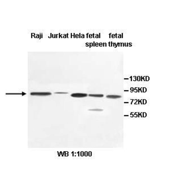 PCIF1 Antibody from Signalway Antibody (39532) - Antibodies.com