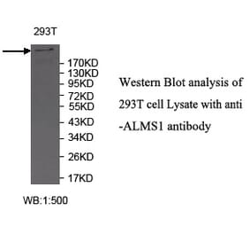 ALMS1 Antibody from Signalway Antibody (39718) - Antibodies.com