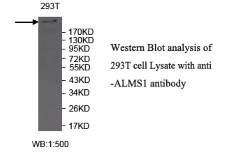 ALMS1 Antibody from Signalway Antibody (39718) - Antibodies.com