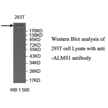 ALMS1 Antibody from Signalway Antibody (39718) - Antibodies.com