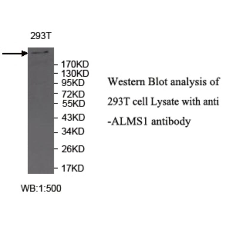 ALMS1 Antibody from Signalway Antibody (39718) - Antibodies.com