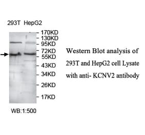 KCNV2 Antibody from Signalway Antibody (39730) - Antibodies.com