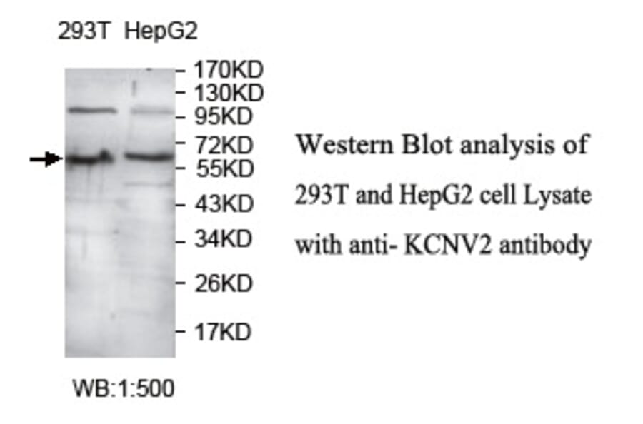 KCNV2 Antibody from Signalway Antibody (39730) - Antibodies.com