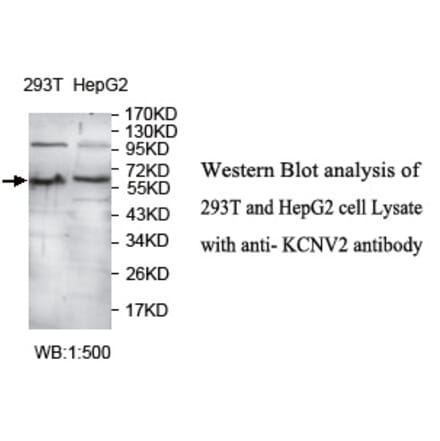 KCNV2 Antibody from Signalway Antibody (39730) - Antibodies.com