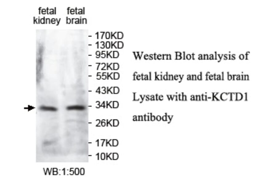 KCTD1 Antibody from Signalway Antibody (39731) - Antibodies.com