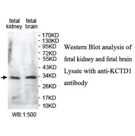KCTD1 Antibody from Signalway Antibody (39731) - Antibodies.com