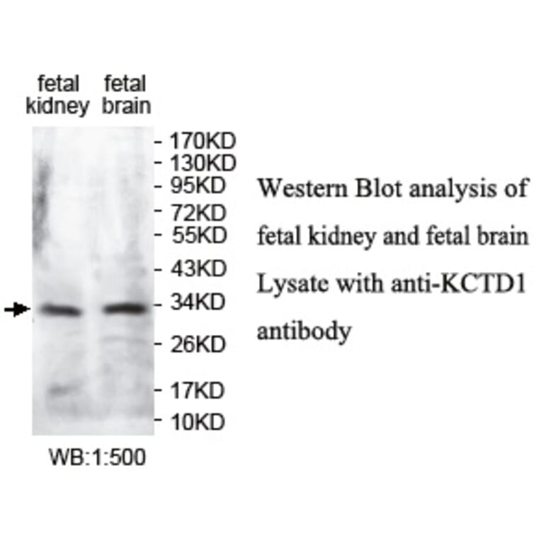 KCTD1 Antibody from Signalway Antibody (39731) - Antibodies.com