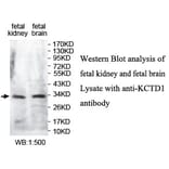 KCTD1 Antibody from Signalway Antibody (39731) - Antibodies.com
