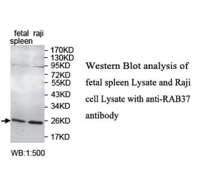 RAB37 Antibody from Signalway Antibody (39738) - Antibodies.com