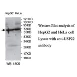 USP22 Antibody from Signalway Antibody (39751) - Antibodies.com