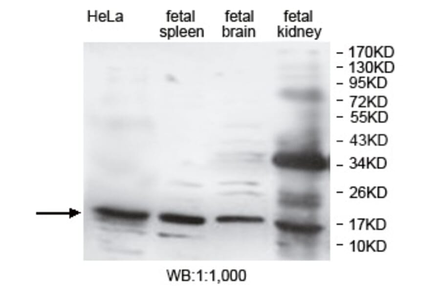 DUSP3 Antibody from Signalway Antibody (39752) - Antibodies.com