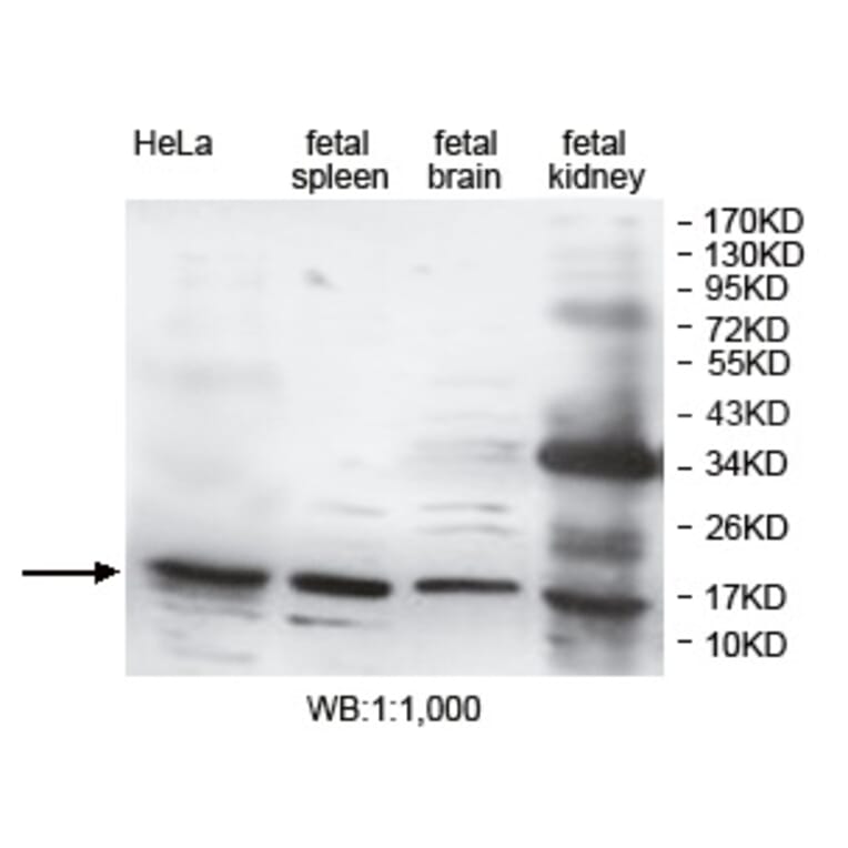 DUSP3 Antibody from Signalway Antibody (39752) - Antibodies.com