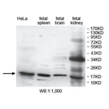 DUSP3 Antibody from Signalway Antibody (39752) - Antibodies.com