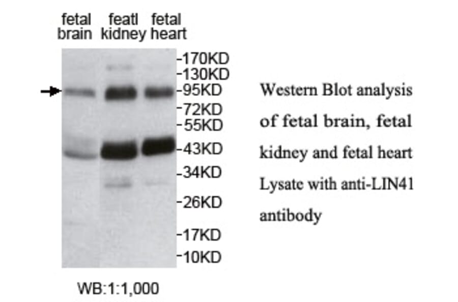 LIN41 Antibody from Signalway Antibody (39754) - Antibodies.com