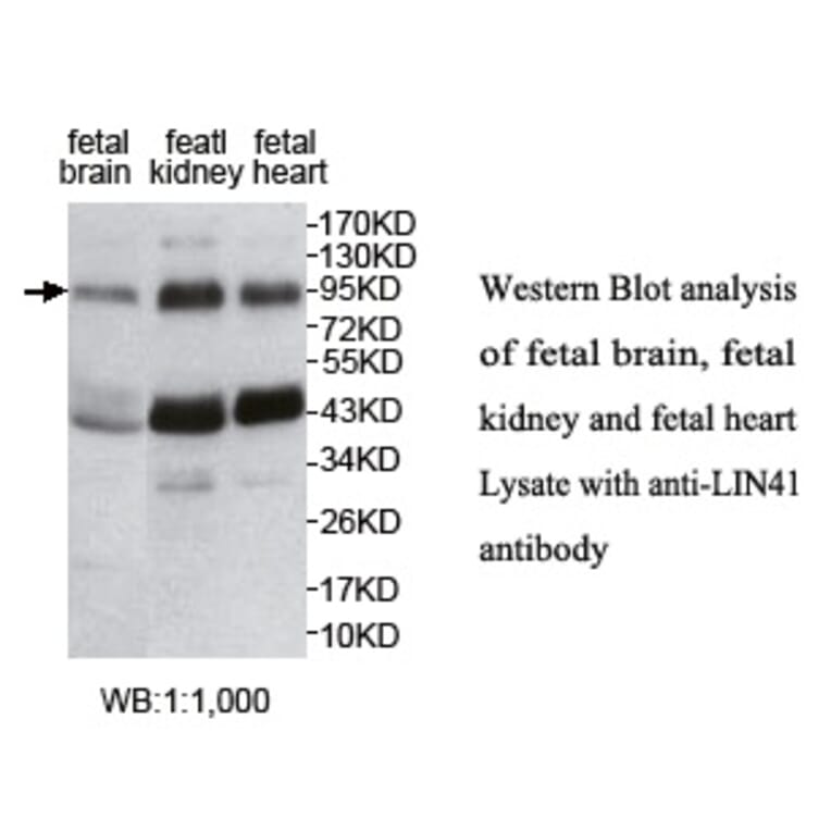 LIN41 Antibody from Signalway Antibody (39754) - Antibodies.com