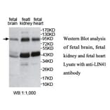 LIN41 Antibody from Signalway Antibody (39754) - Antibodies.com