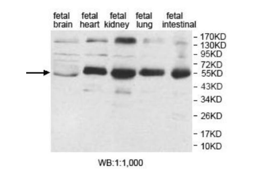 AP1M2 Antibody from Signalway Antibody (39922) - Antibodies.com