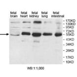 AP1M2 Antibody from Signalway Antibody (39922) - Antibodies.com